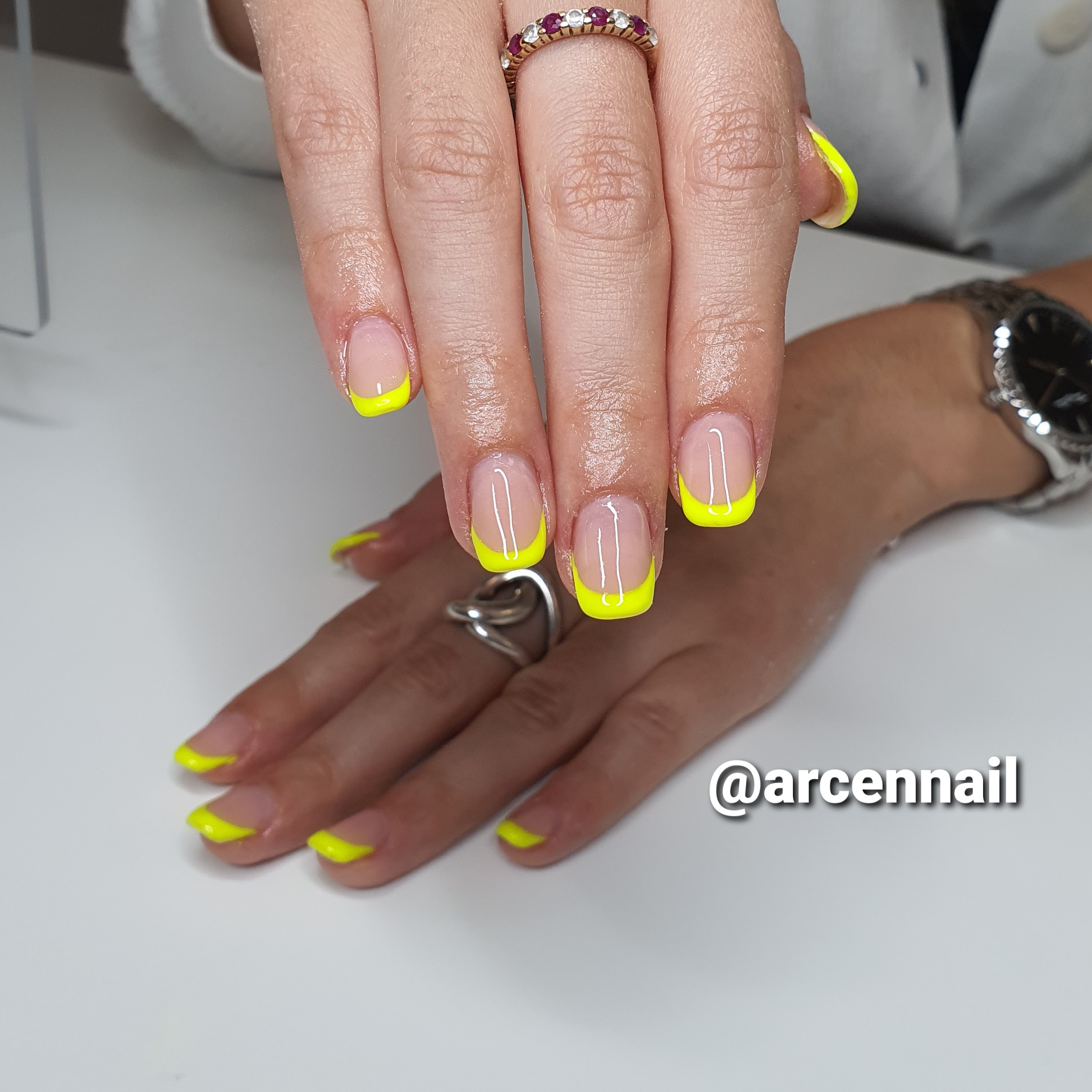 pose-ongles-resine-toulouse-french-fluo-jaune